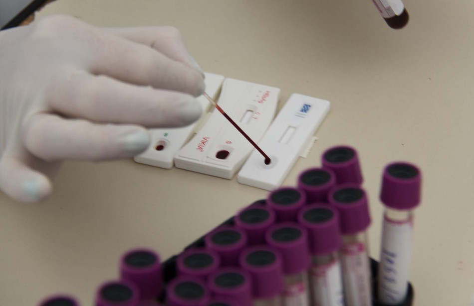 Equipes de saúde fazem 736 exames no dia de combate ao HIV