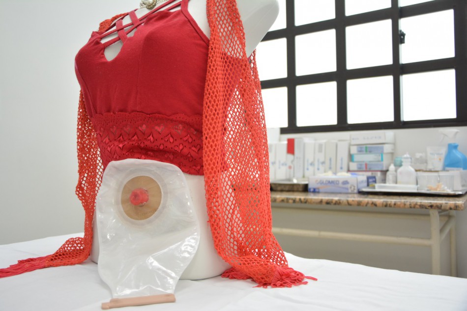 Pacientes ostomizados contam com serviço exclusivo em Blumenau